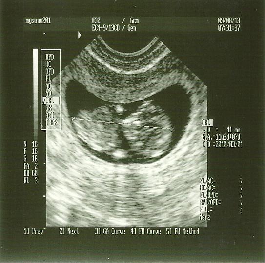 Baby Taylor #2 11 Weeks